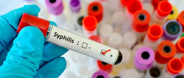 syphilis